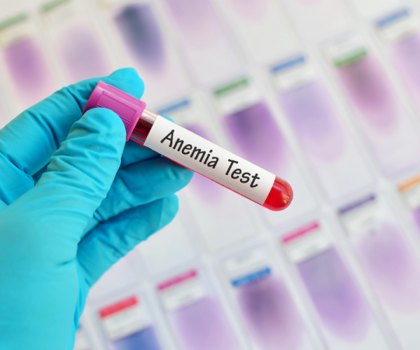 anemia blood test